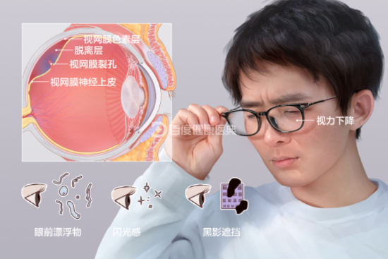 20220429796169.png image.png